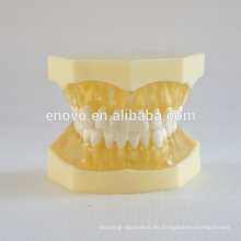 Modelo dental 13013 de la mandíbula suave transparente modelo anatómico médica de China